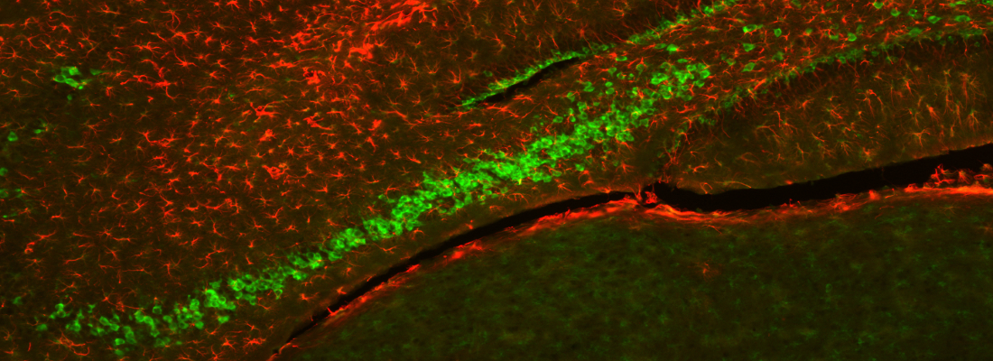 Immunofluorescence  Neurons in Brain Section